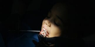 Jak przebiega wizyta adaptacyjna u dentysty dziecięcego i dlaczego nie warto z nią zwlekać do bólu Zbliżenie na dziecko podczas badania stomatologicznego w gabinecie