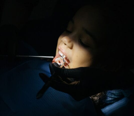 Jak przebiega wizyta adaptacyjna u dentysty dziecięcego i dlaczego nie warto z nią zwlekać do bólu Zbliżenie na dziecko podczas badania stomatologicznego w gabinecie