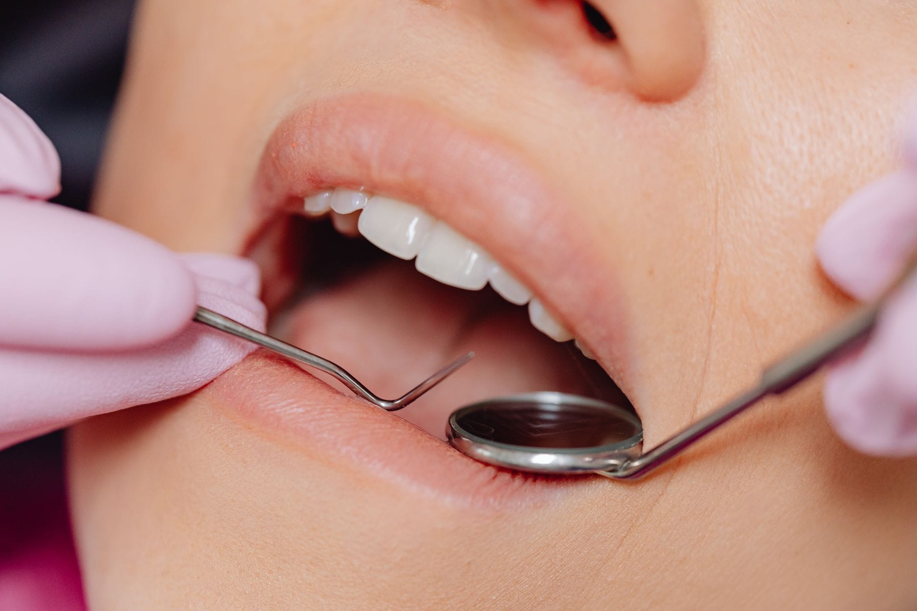 Zbliżenie na badanie stomatologiczne z użyciem narzędzi dentystycznych